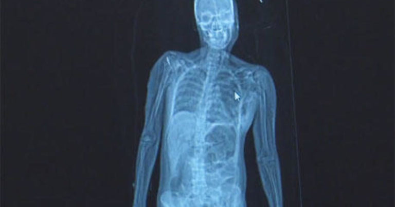 New technology a "game changer" for autopsies