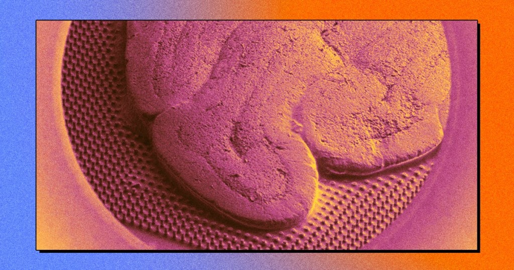 Scientists Are Weaving Human Brain Cells Into Microchips