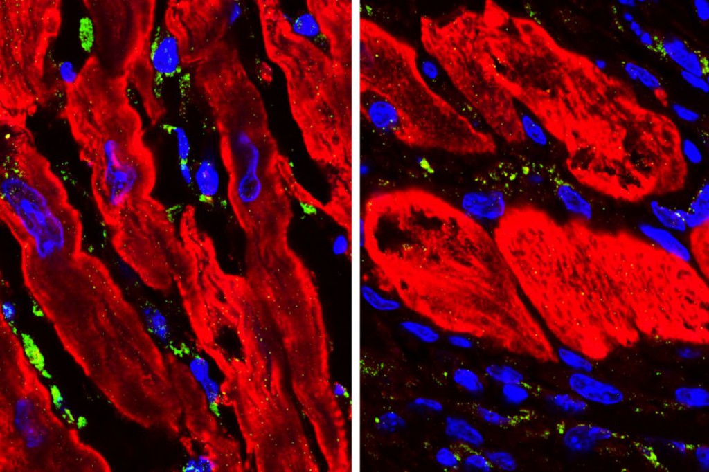 Researchers discover an unexpected regulator of heart repair