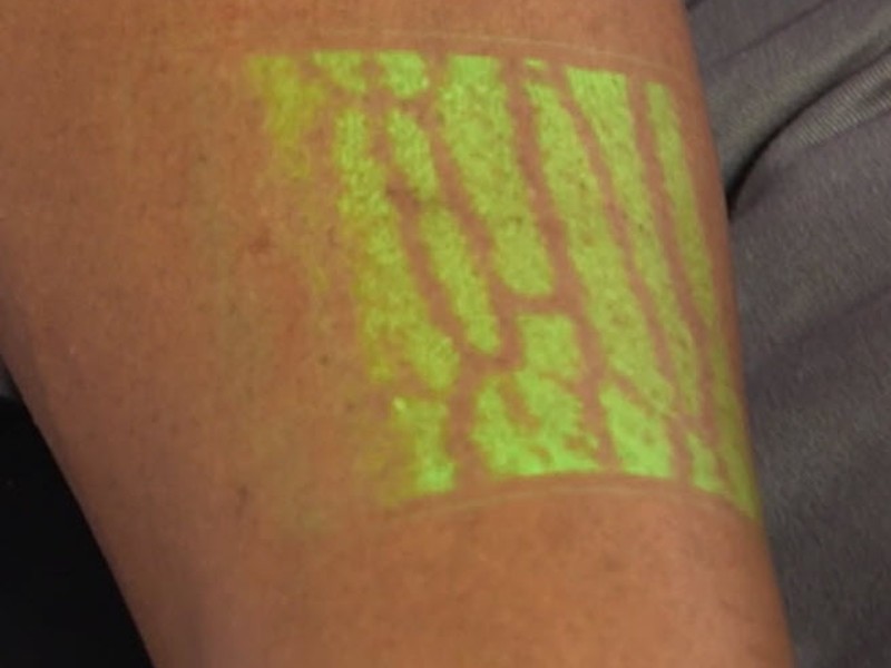 5 augmented reality tools improving patient care