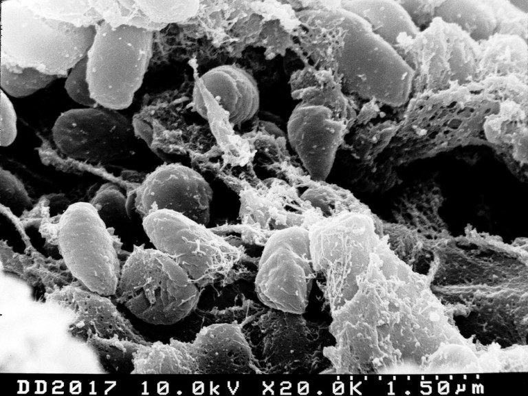 Medieval Skeletons Reveal How the Bubonic Plague Influenced Human DNA