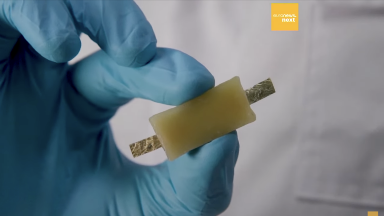 Who Knew Eating Batteries Was This Much of a Problem?