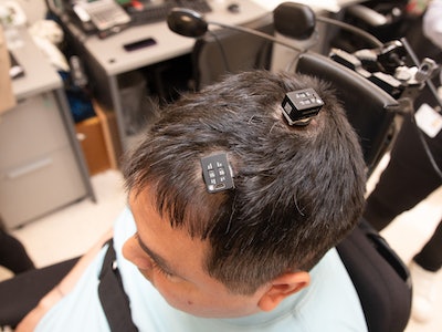 New AI-Powered Brain Implant Restored Feeling And Movement For A Quadriplegic Man