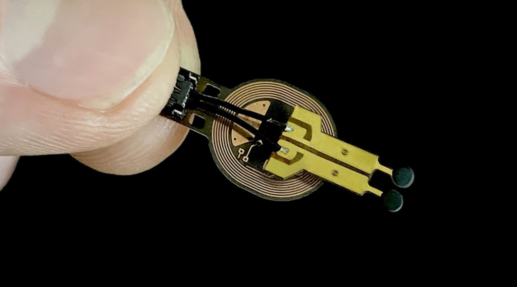 Predicting wound healing with a wound-integrated miniaturized sensor