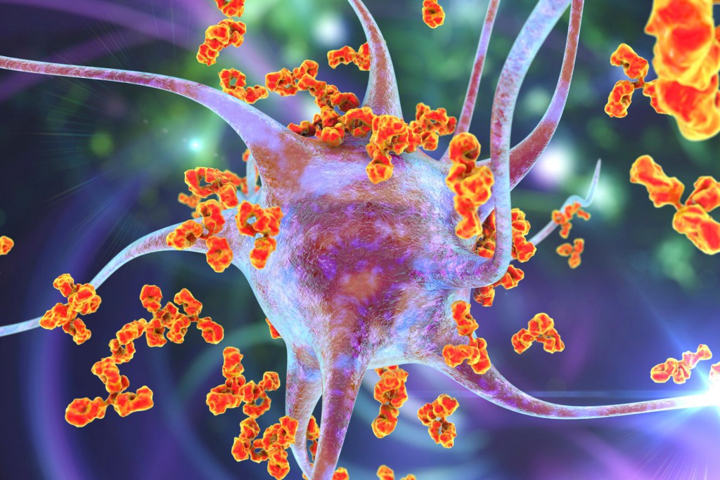 “Inverse vaccine” reverses autoimmune diseases like MS, diabetes & arthritis