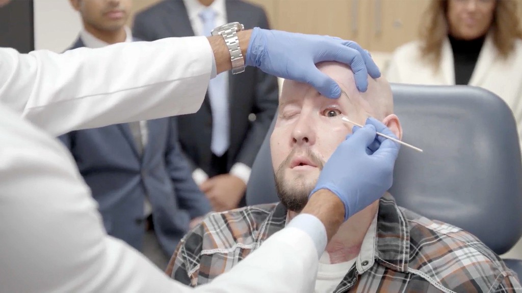 Arkansas man receives world’s first eye transplant