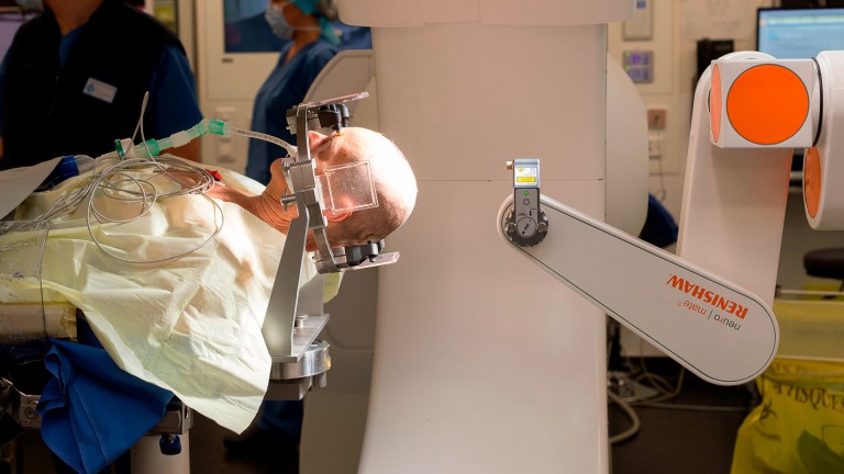 When Addiction Treatment Fails, Can a Brain Implant Succeed?