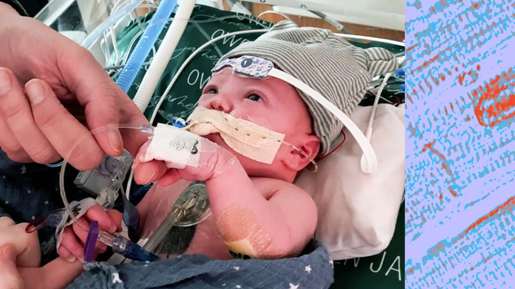 Toddler thriving after world’s first partial heart transplant