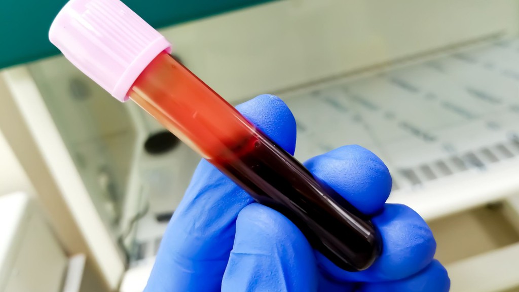 New drug shows promise in controlling deadly blood cancer