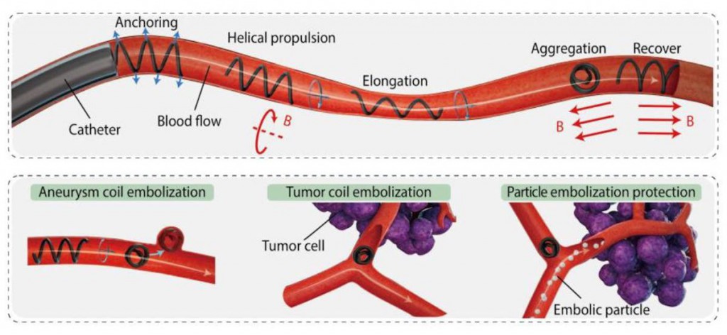 Magnetic microbots show promise for treating aneurysms and brain tumours