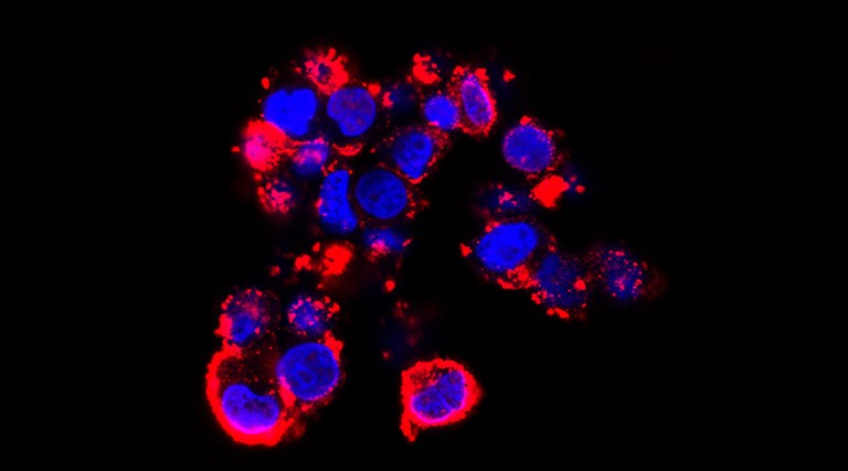 Nanoparticles deliver gene therapy to hard-to-reach brain tumors