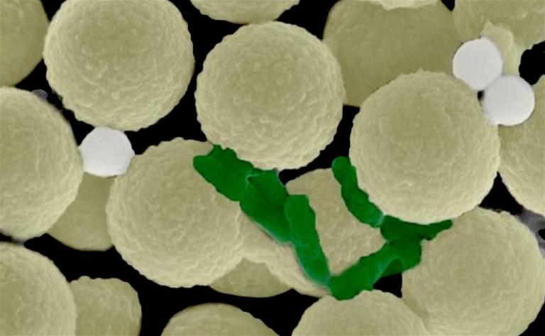 Scientists Create Swarming Micro-Robots That Can “Hunt” Microplastics and Bacteria Contaminating Water