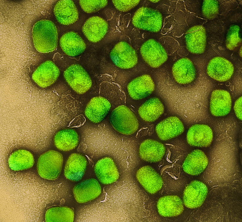 Mpox Detected In Sweden, The First European Case In The Latest Outbreak