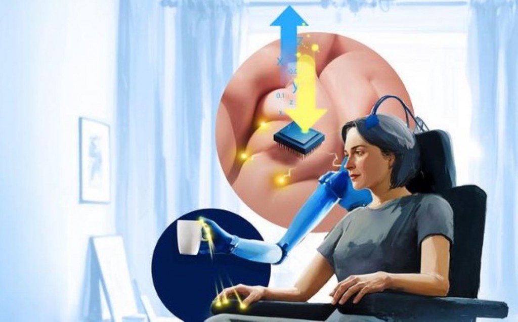 Advancing Prosthetics: Restoring Touch Through Brain Stimulation