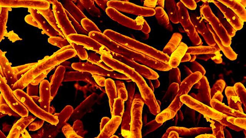 Kansas TB Outbreak Is Reportedly Largest Recorded In US History