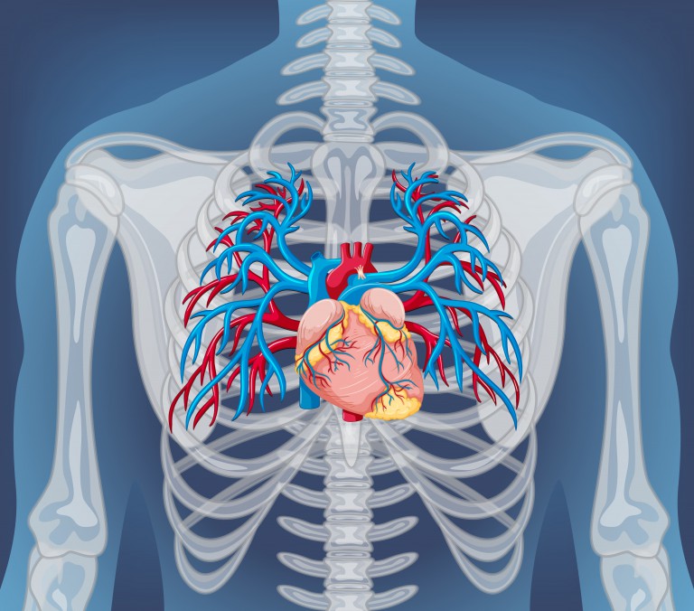 First fully robotic heart transplant in the US performed without opening patient's chest