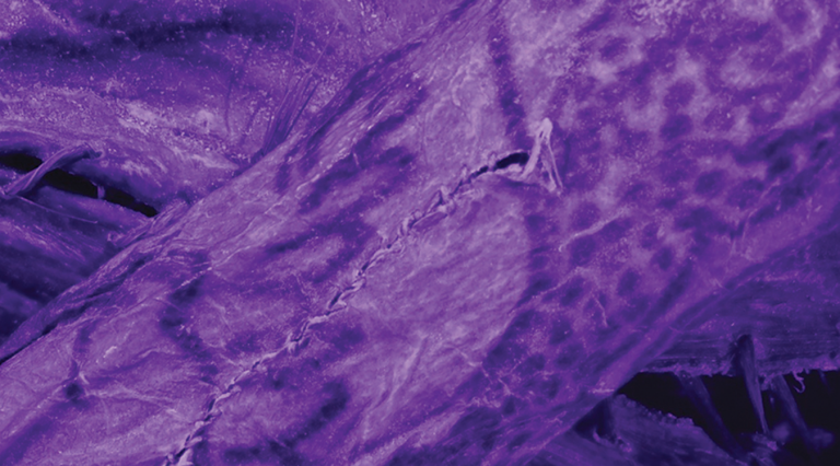 Impossibly Intricate Tattoos Found on 2,000-Year-Old ‘Ice Mummy’