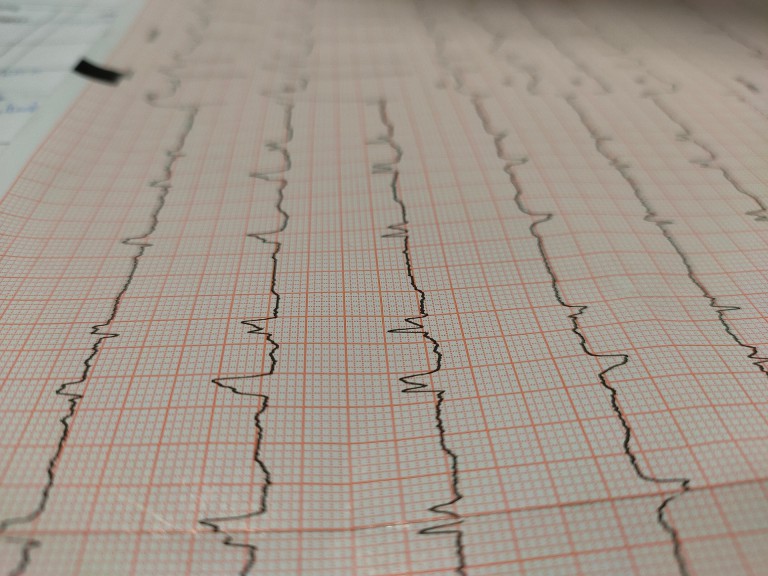 Artificial intelligence can better predict future risk for heart attack patients