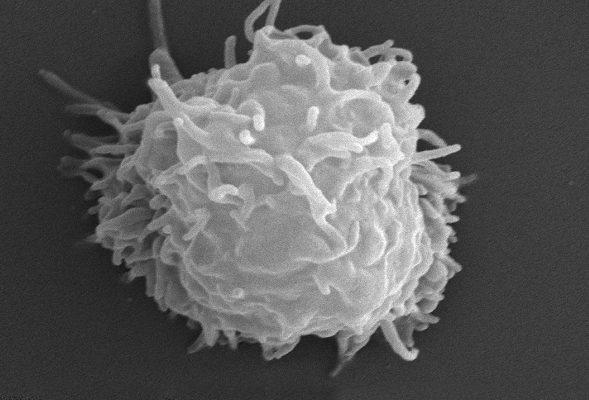 Man dies covered in necrotic lesions after amoebas eat him alive