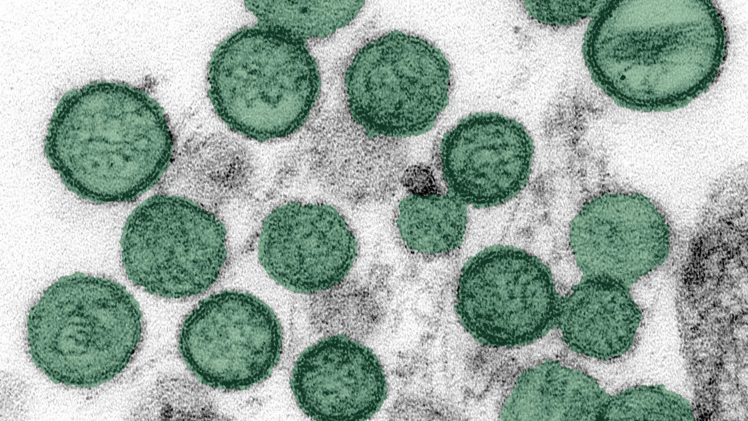 'Oh, gosh': Inside the race to test for cruise ship hantavirus