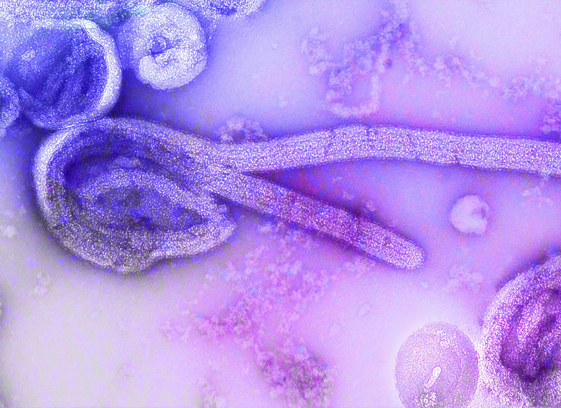 France confirms first Ebola case in doctor who had worked in DRC