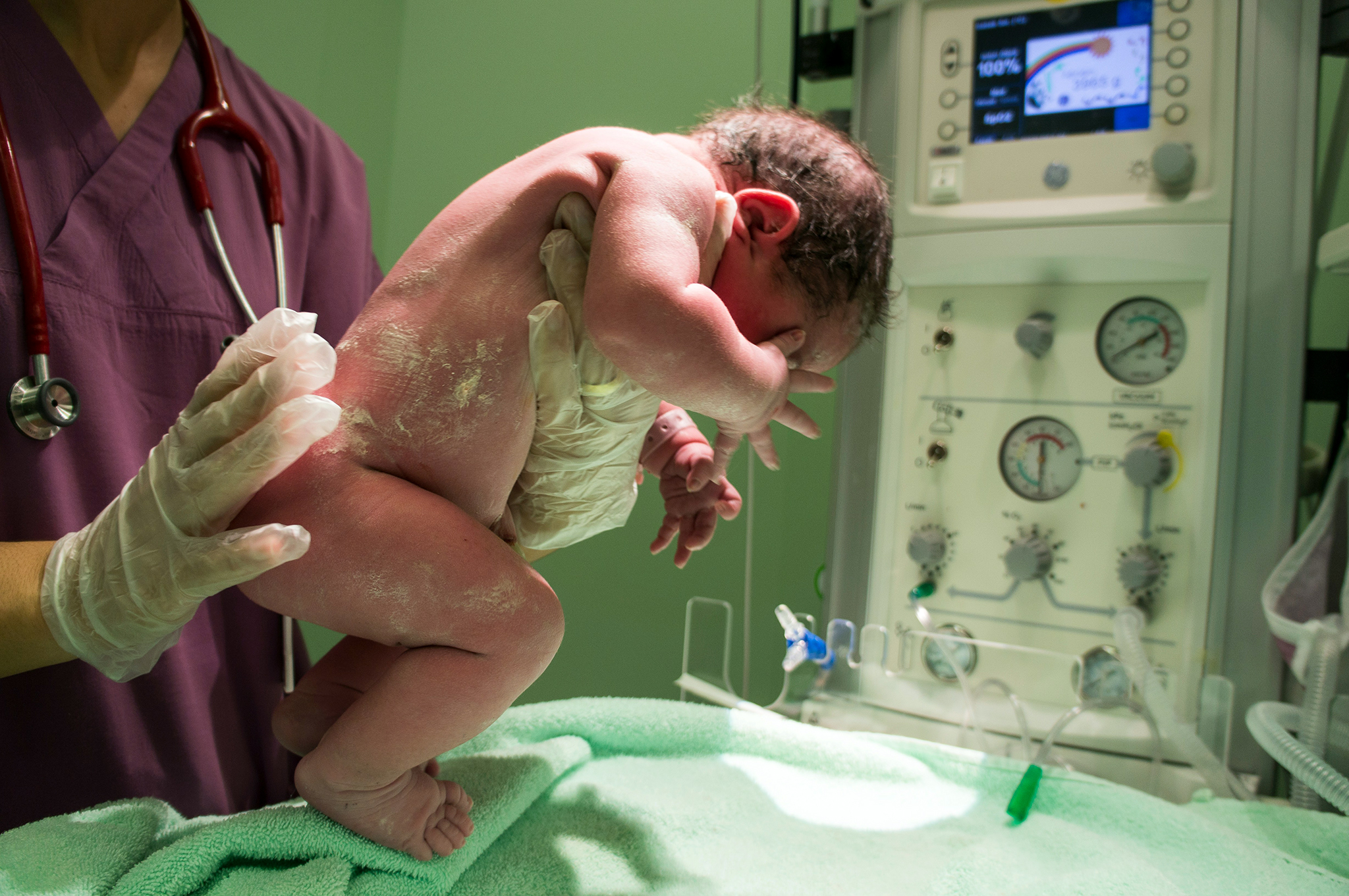Why more male than female newborns may get the crucial vitamin K shot