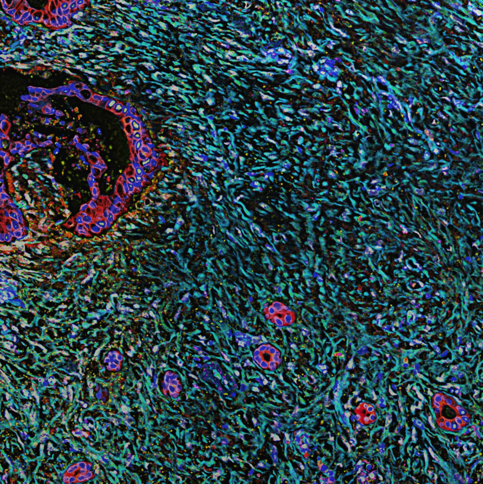 Breakthrough Pill Nearly Doubles Survival Time For One of The Deadliest Cancers