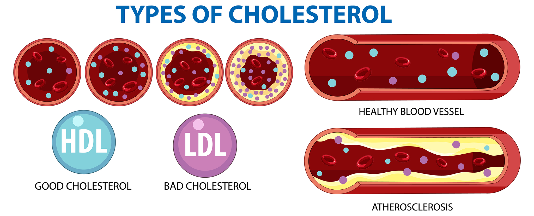 Experimental One-Dose Treatment Cuts 'Bad' Cholesterol by 52% in First Human Trial