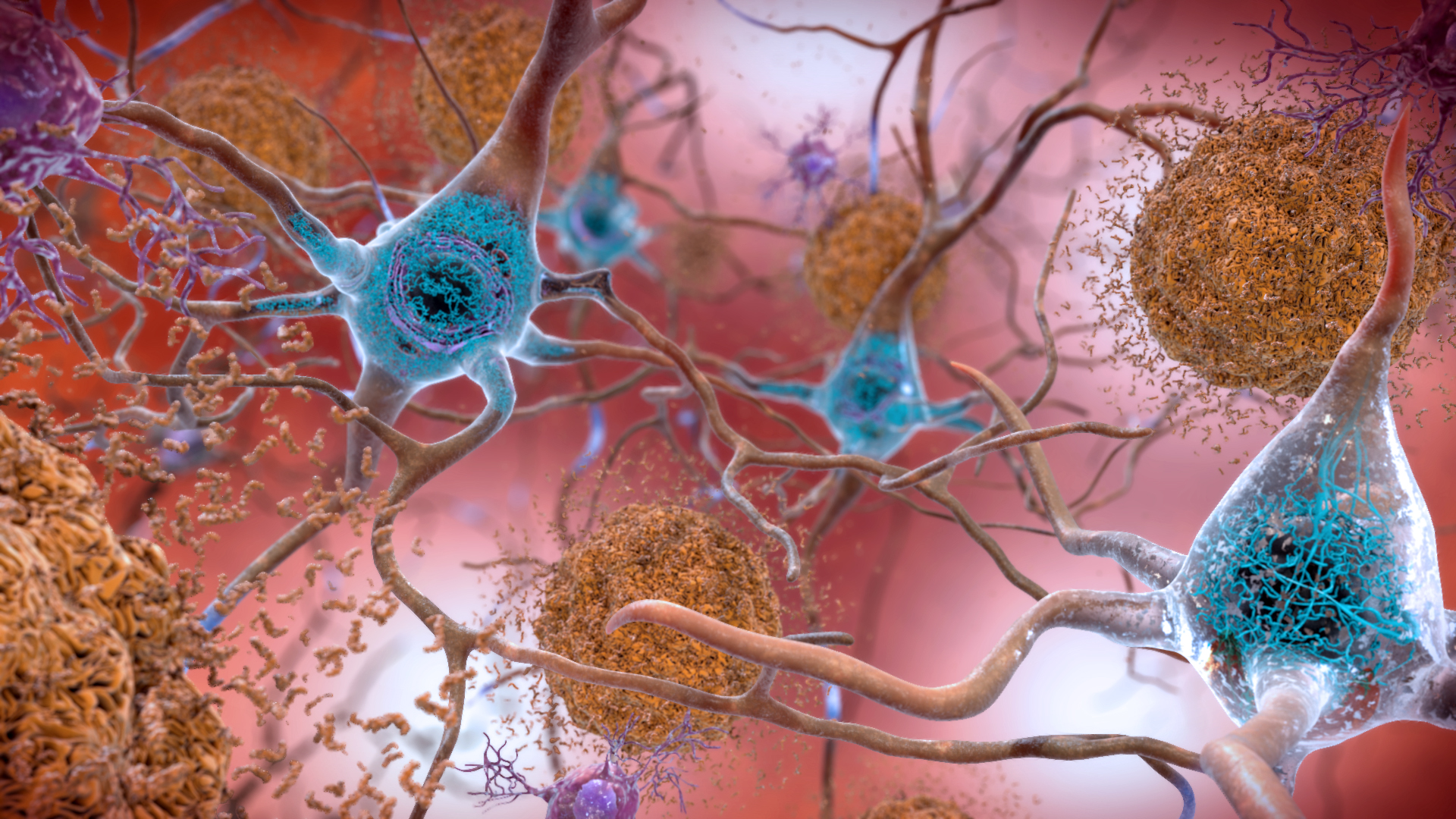 Neurologists Reveal The Overlooked Signs Of Alzheimer’s They Wish Everyone Knew