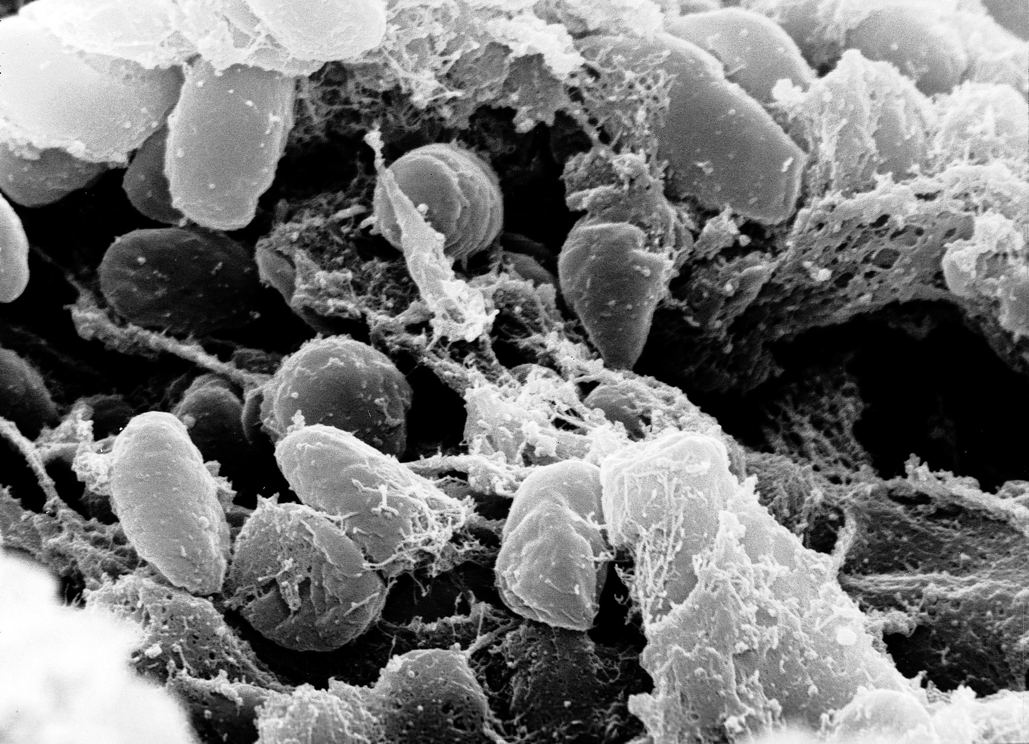 Russia plague: What we know about the suspected case reportedly linked to a lab worker’s death